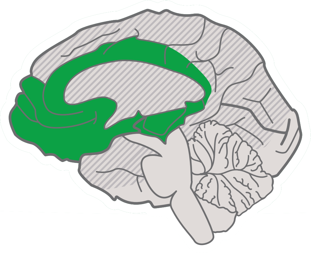 UDL-Engagement
